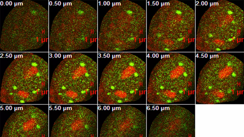 NIU Earns Grant To Acquire High-Tech Microscope
